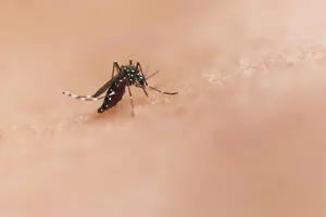 Tanzania Yellow Fever Requirements